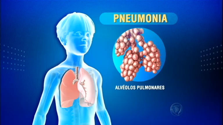 Pneumonia pode ser prevenida por vacina
